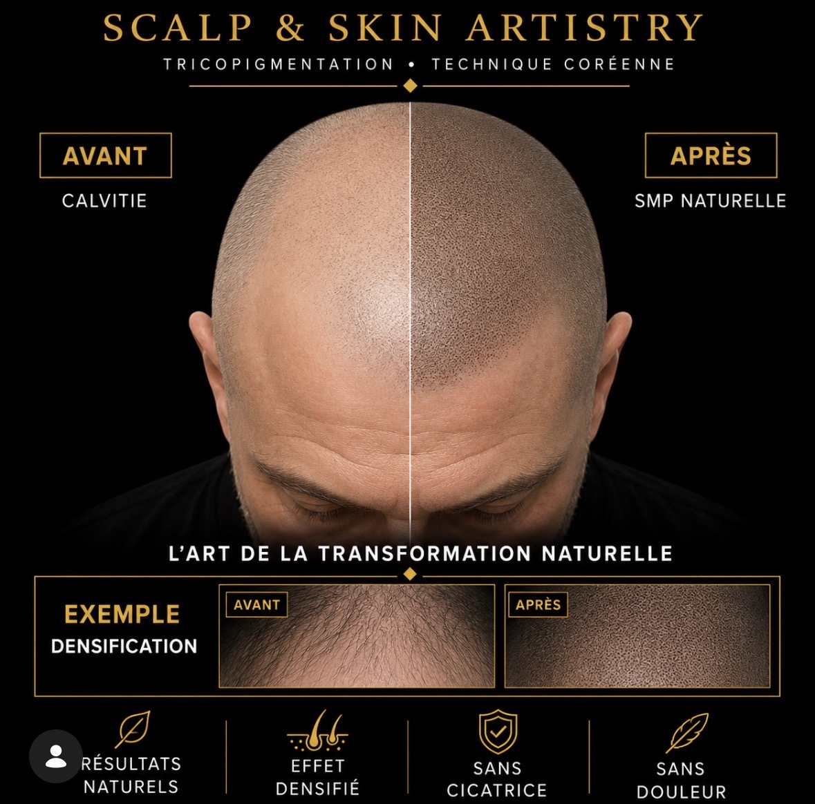 Effet rasé · Homme